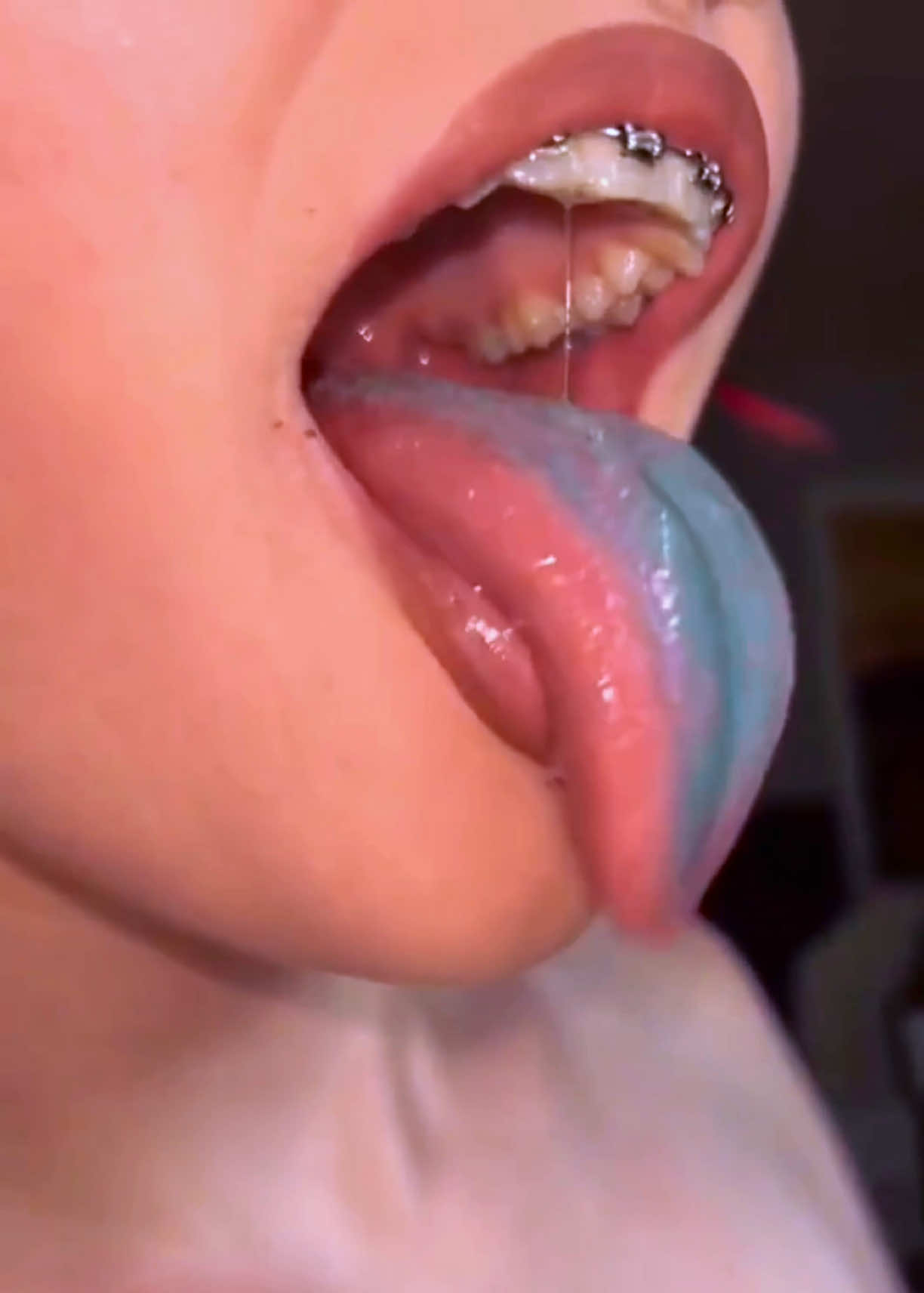 @TeethfairyEvah