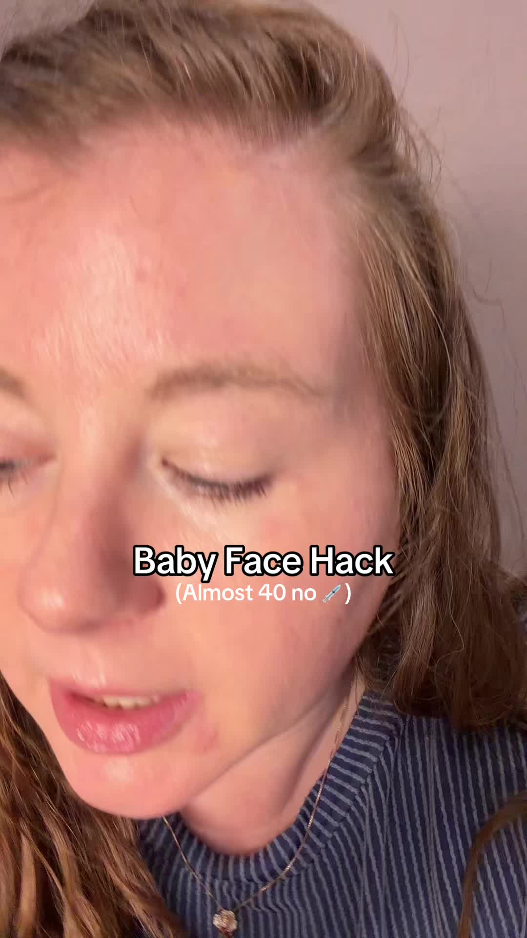 @Robin Lyn Millennial Skin