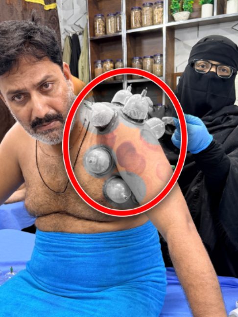 @Doctor & Hijama Cupping Clinic