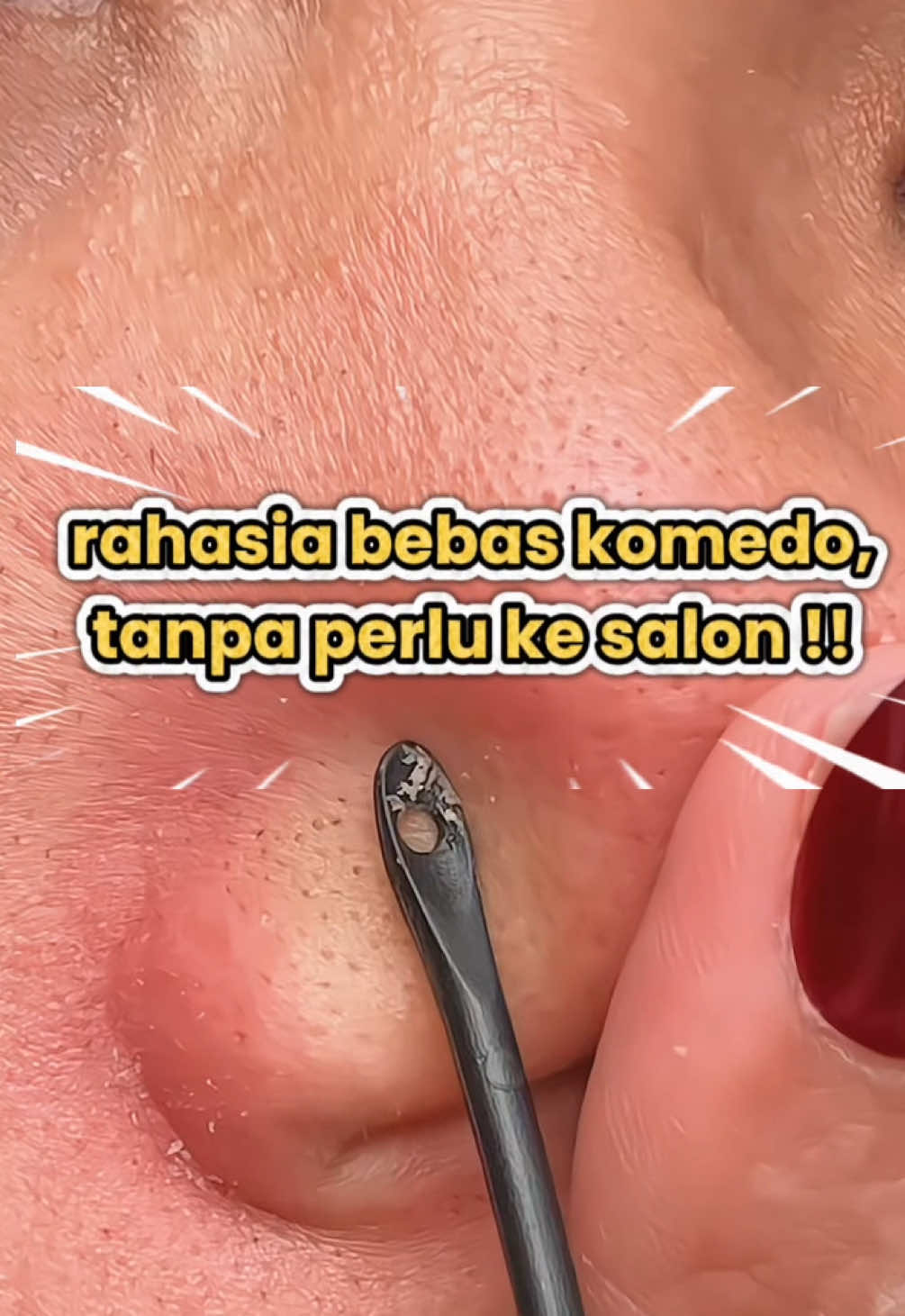 @sweetie