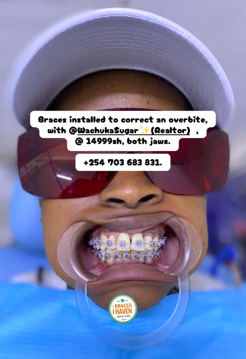 @Braces Haven Nairobi Dental