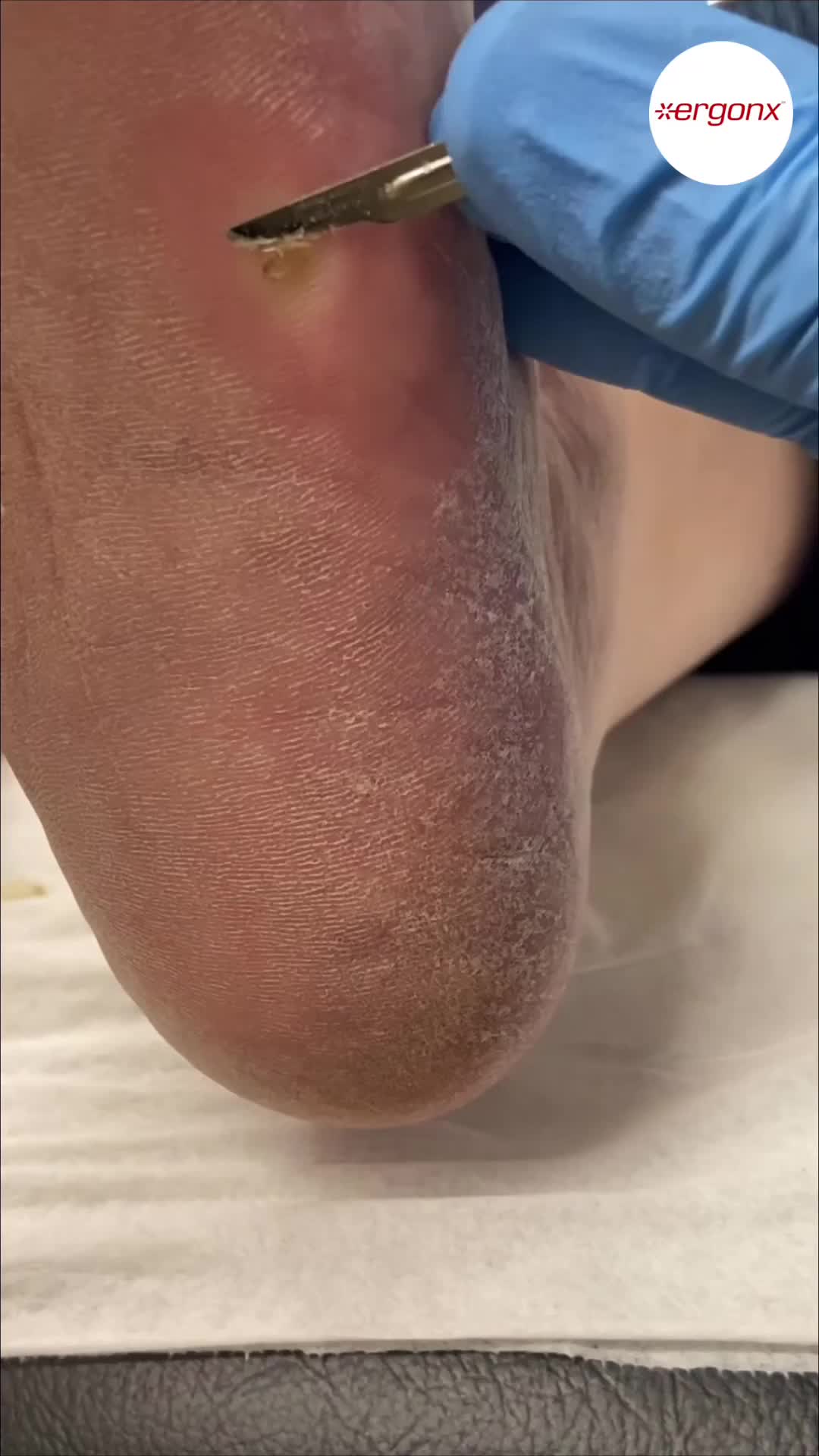 @ergonx