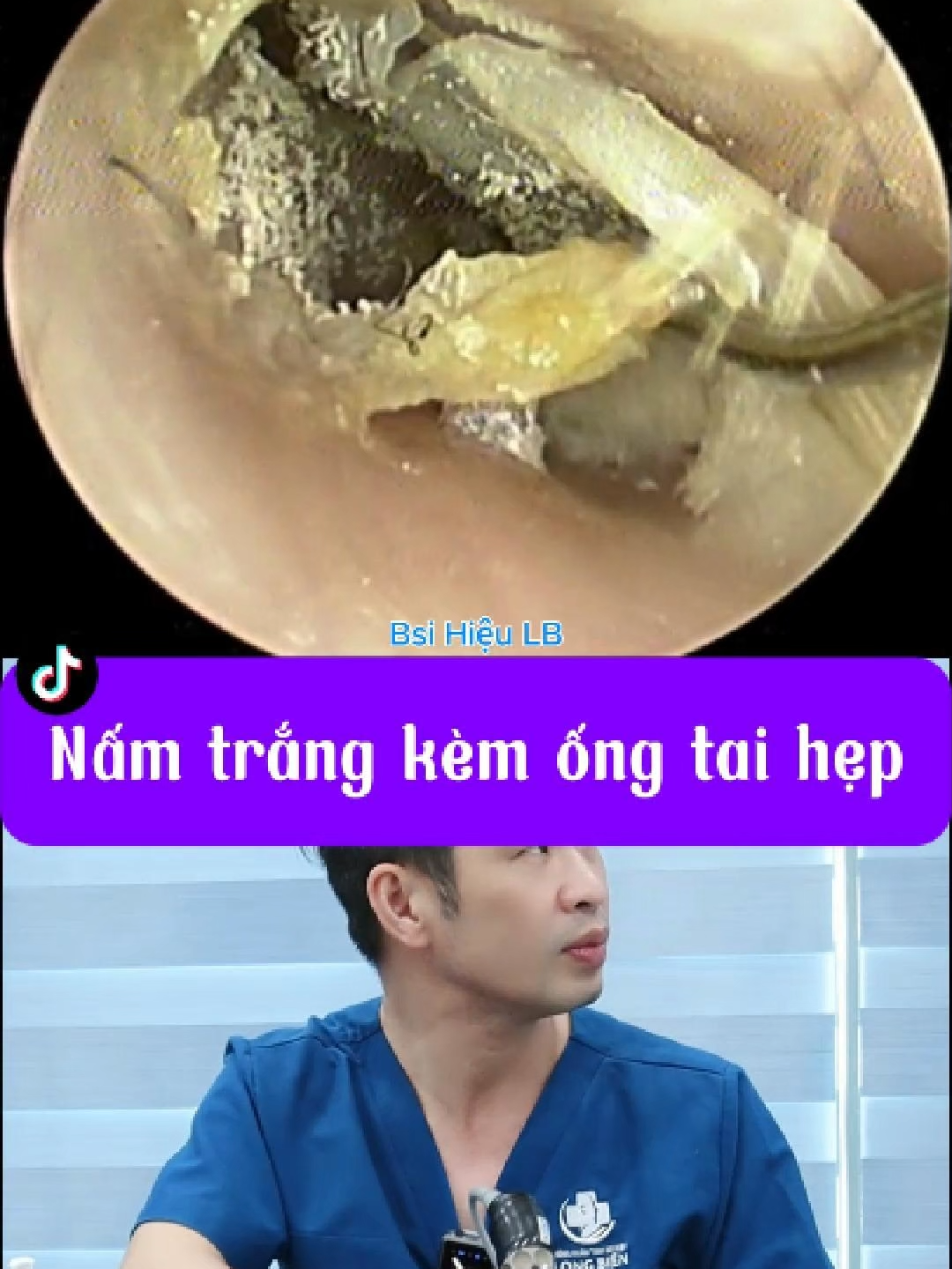 @Bs Hiệu Tai Mũi Họng Long Biên