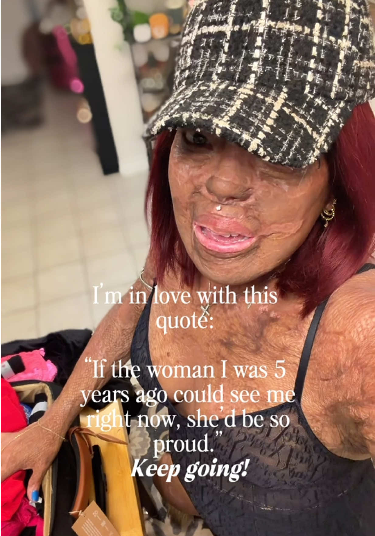 @Burned Beauty 2018&reg;️