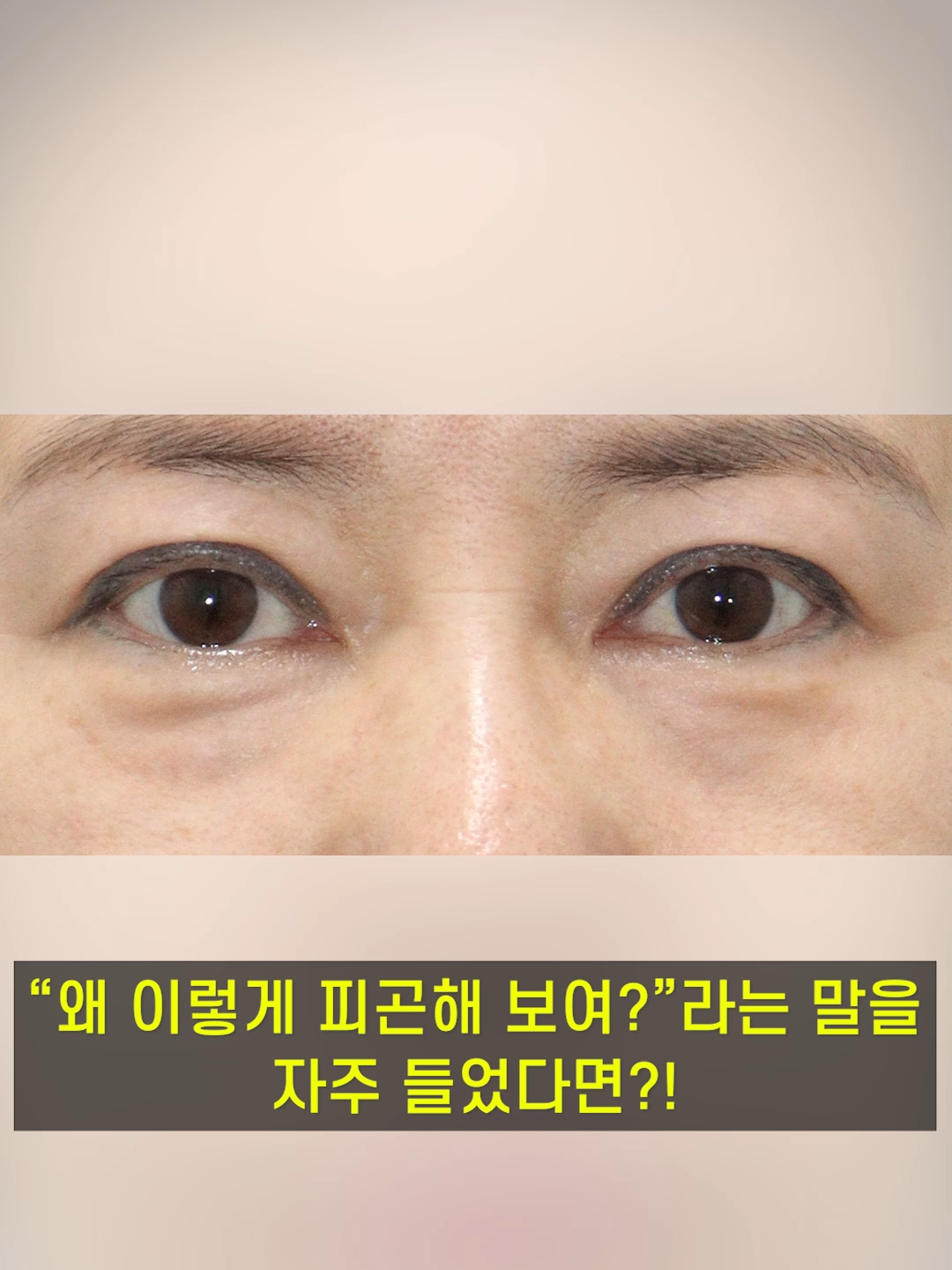 @다시피움성형외과 DASIPIUM タシピウム