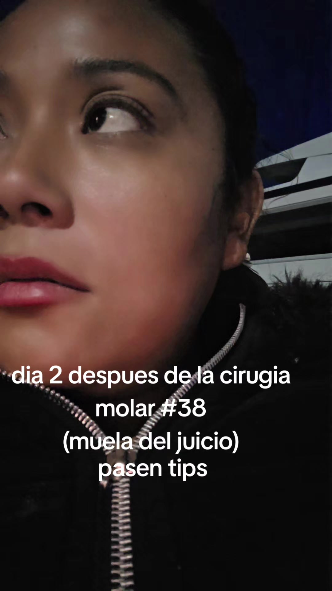 @Leidy Bartolon