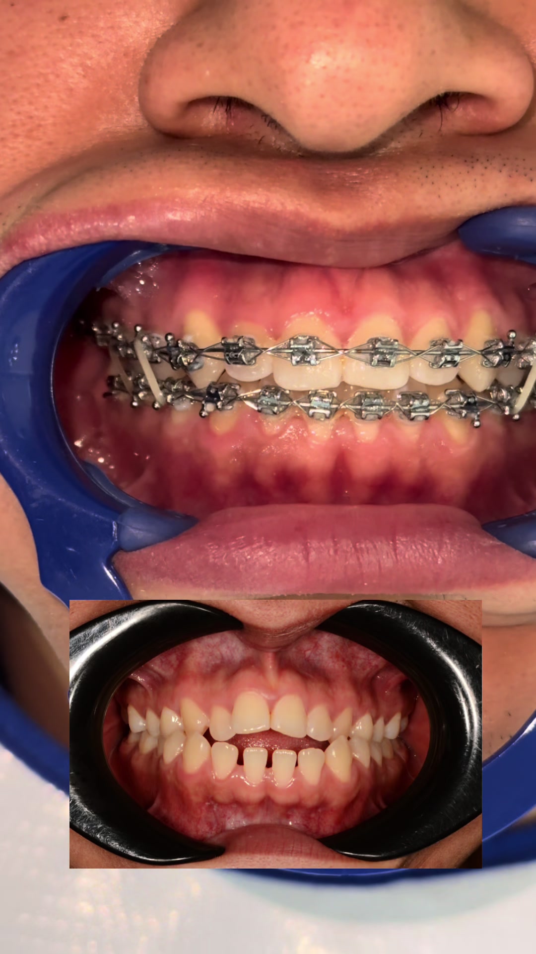 @Dr. Juan Perez | Ortodoncista