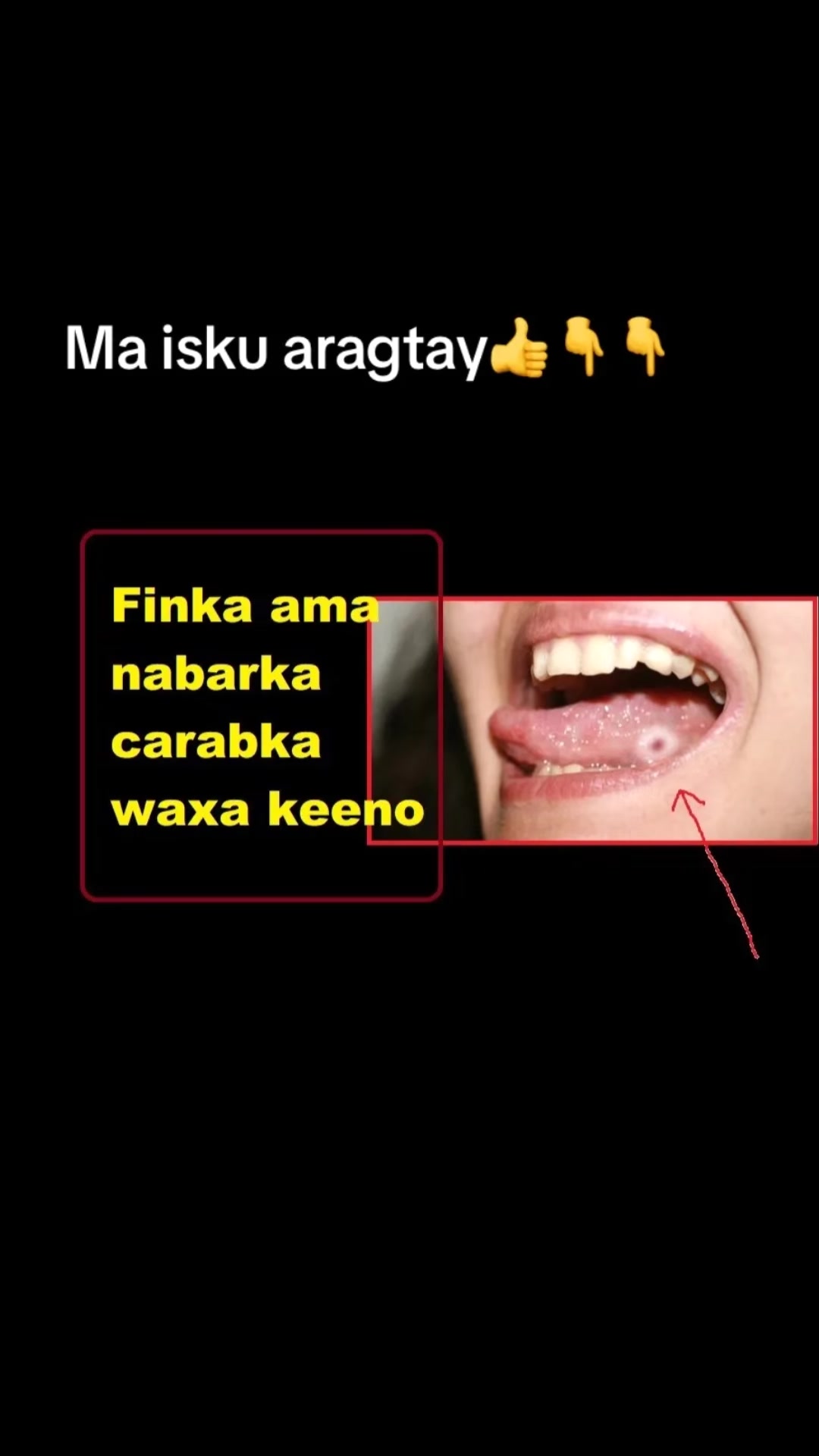 @Somali Doctors