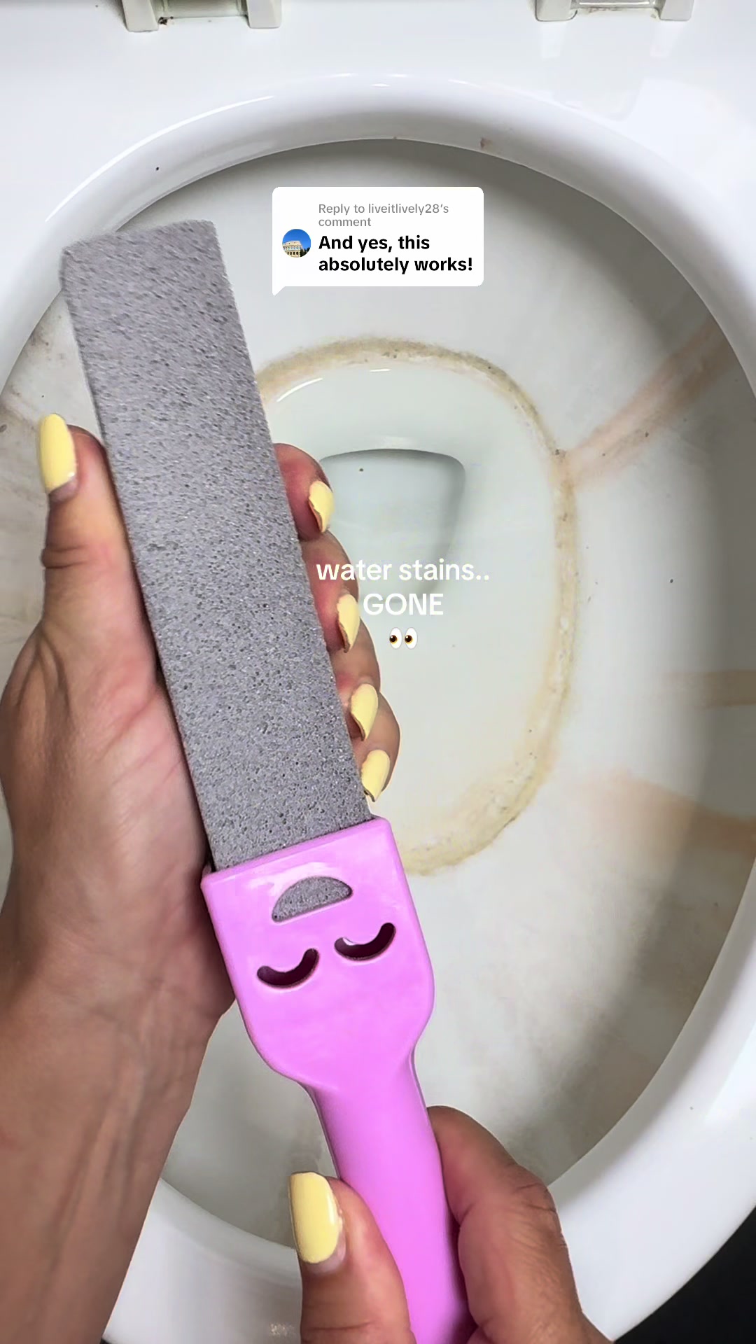 @A N I K O