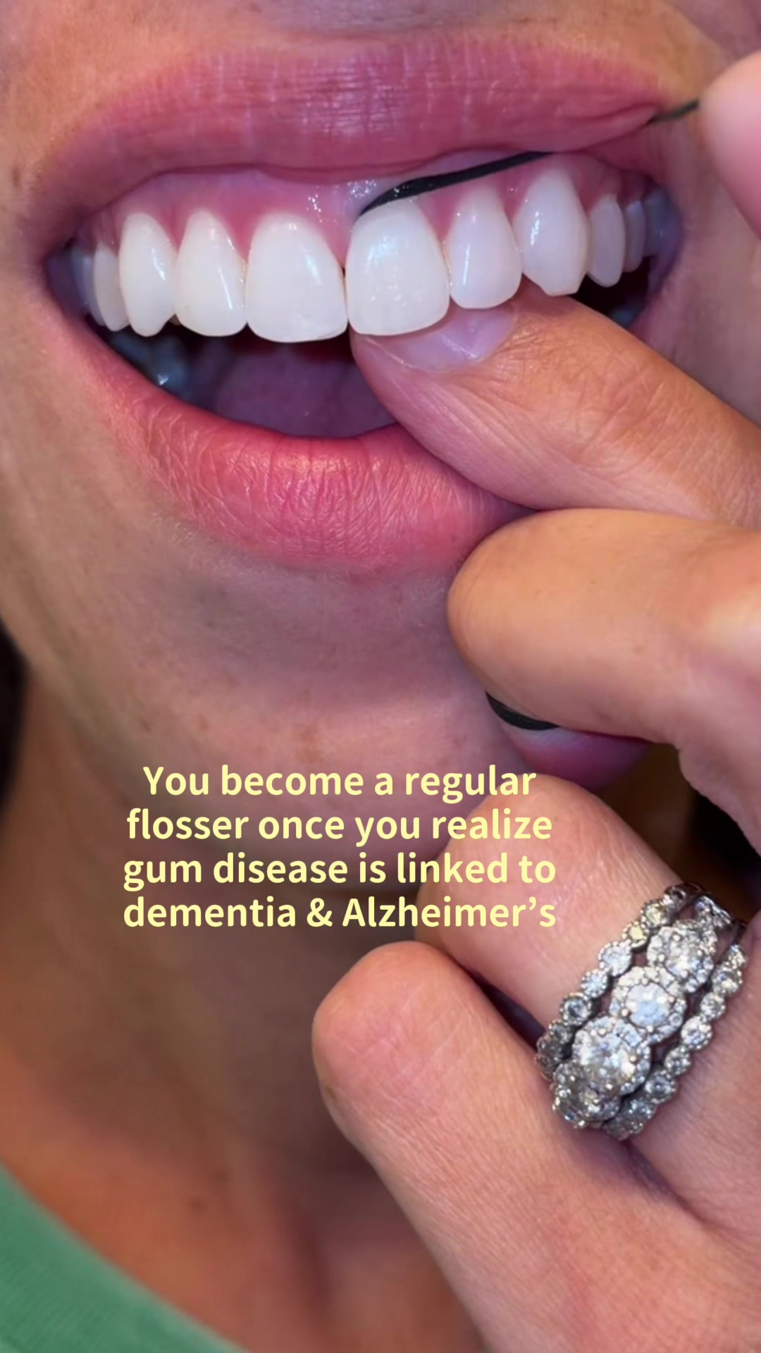 @Kellee &bull; Dental Hygienist