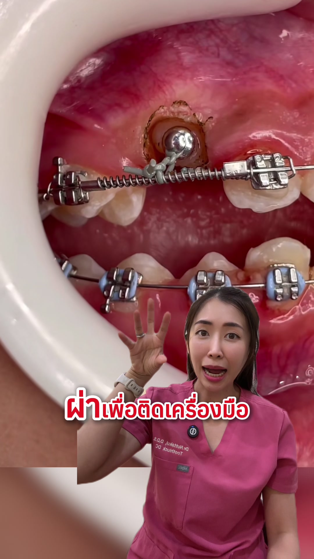 @ณัฐคุณ (Nuttakul Dent) 🦷