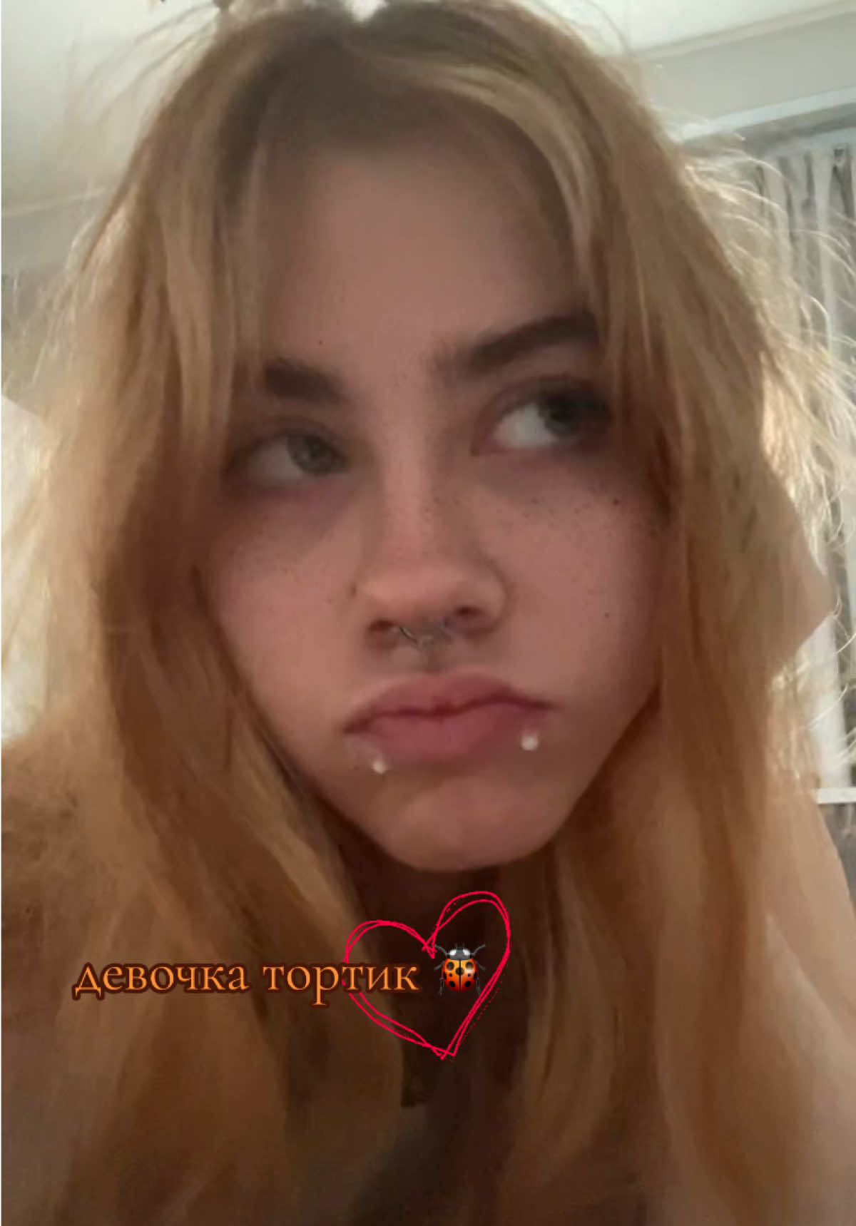@🐞