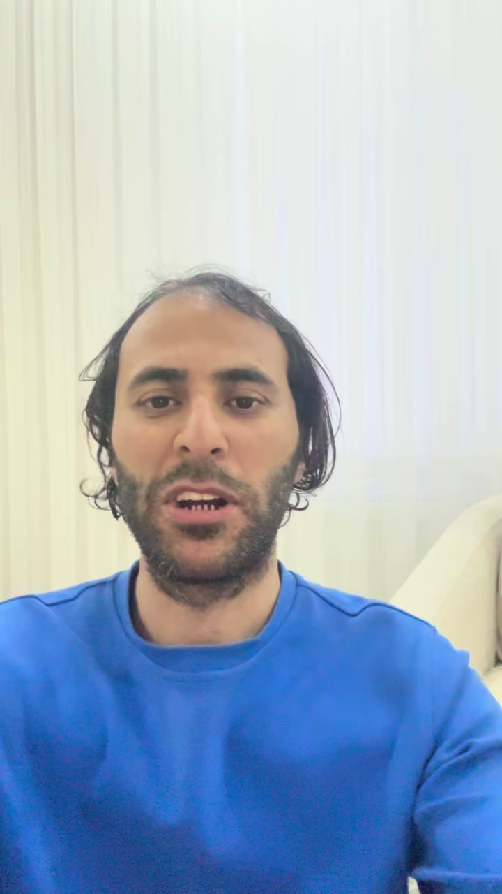 @HOPTİK ZOPTİK &Ccedil;UPALA BURHAN