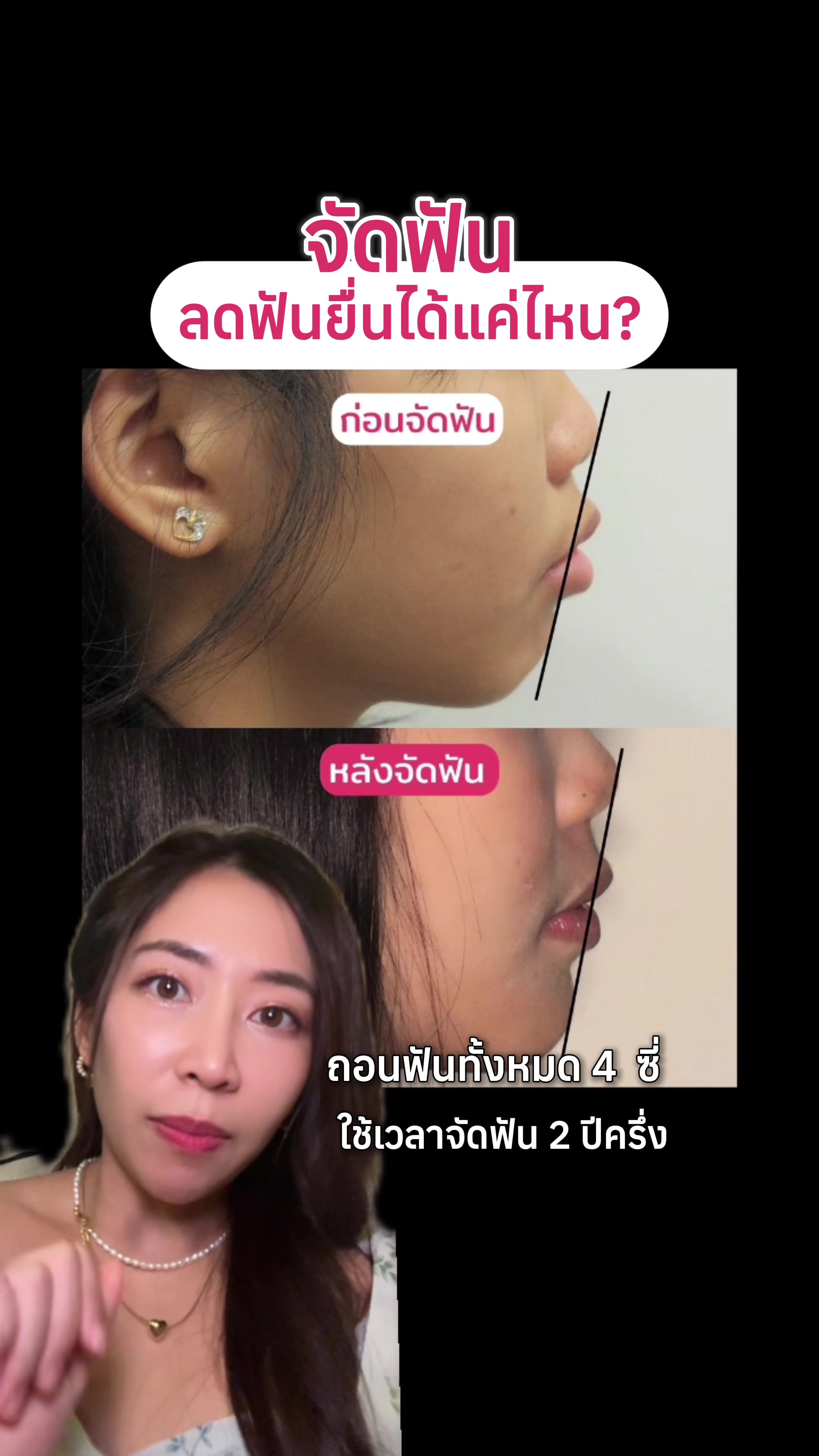 @ณัฐคุณ (Nuttakul Dent) 🦷