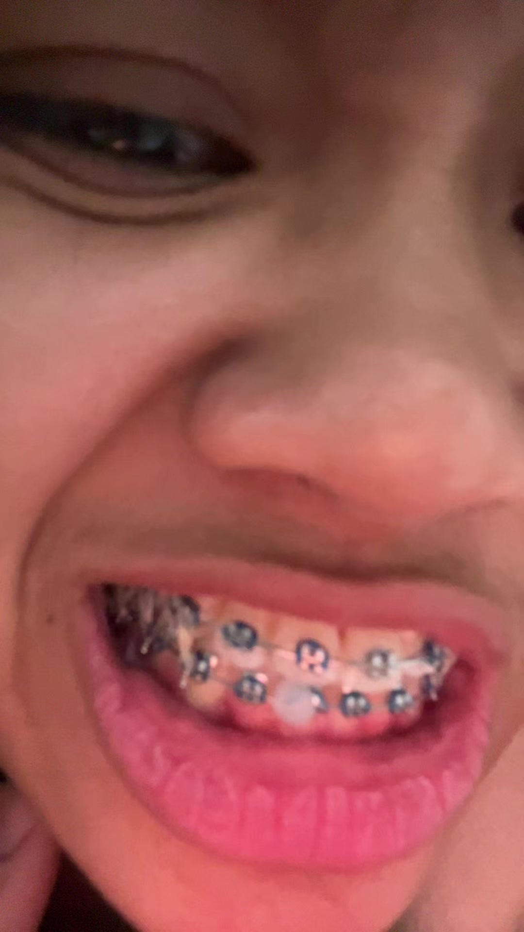 @nyinyissss😬