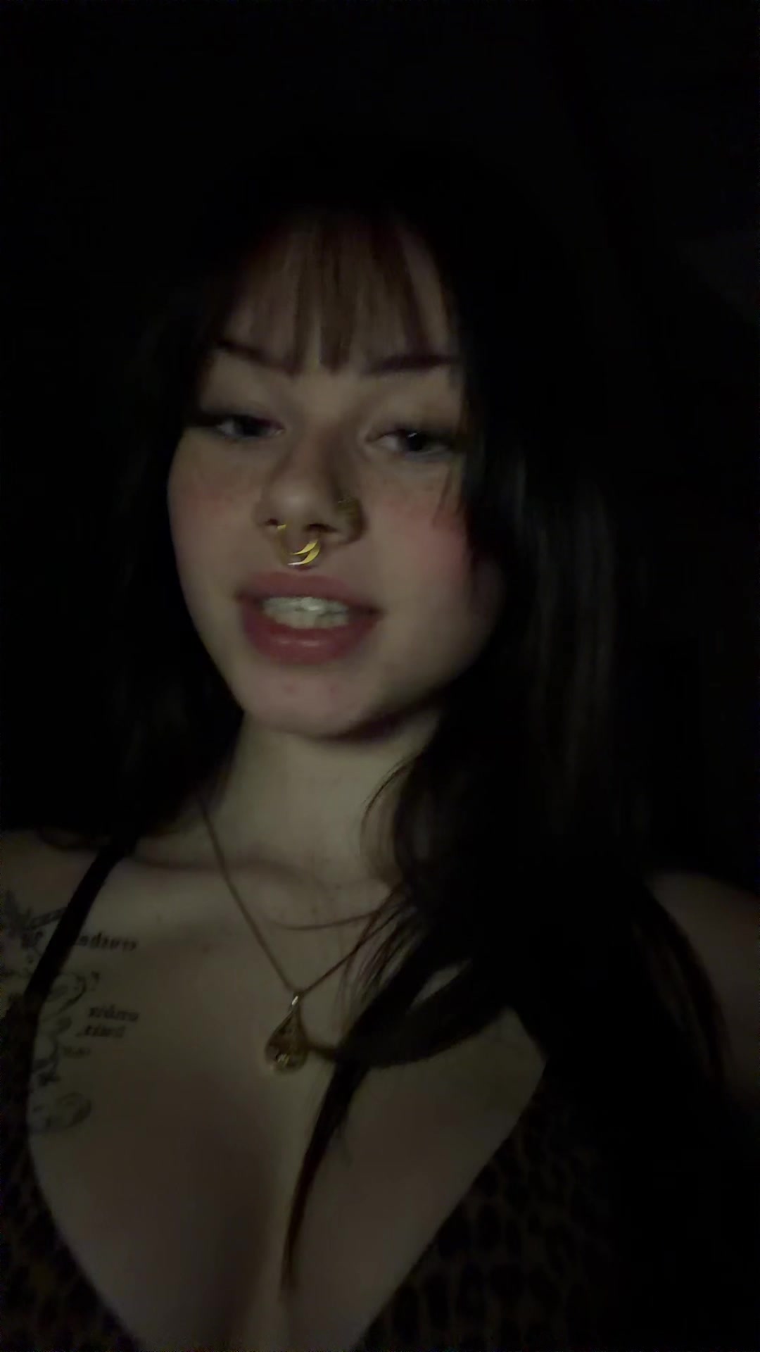 @🩻
