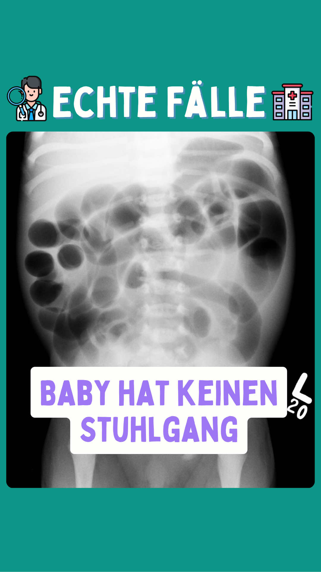 @Hand, Fuß, Mund