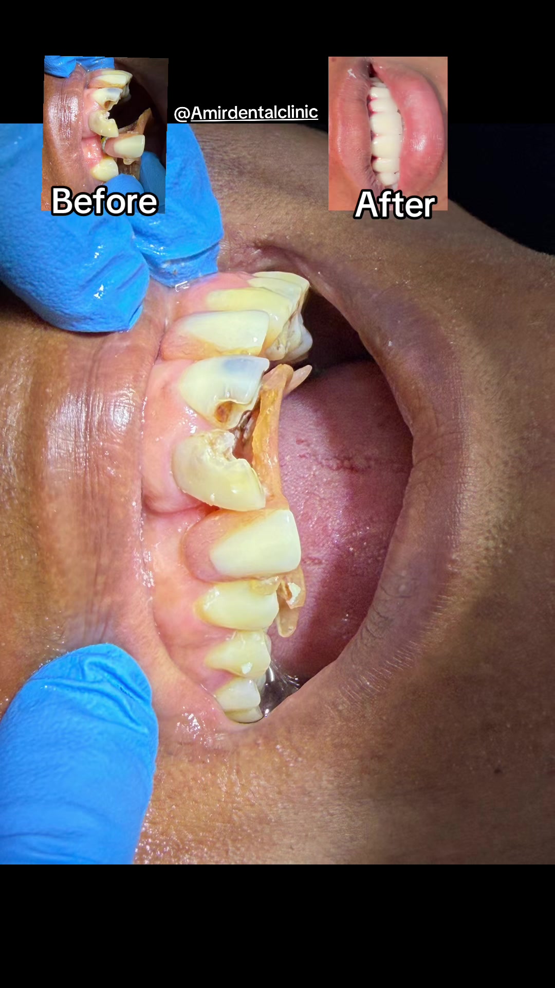 @Faye Biram Dental 🦷