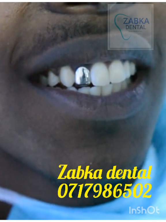 @Zabka Dental