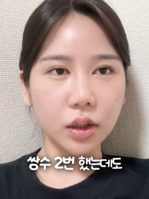 @디에이성형외과