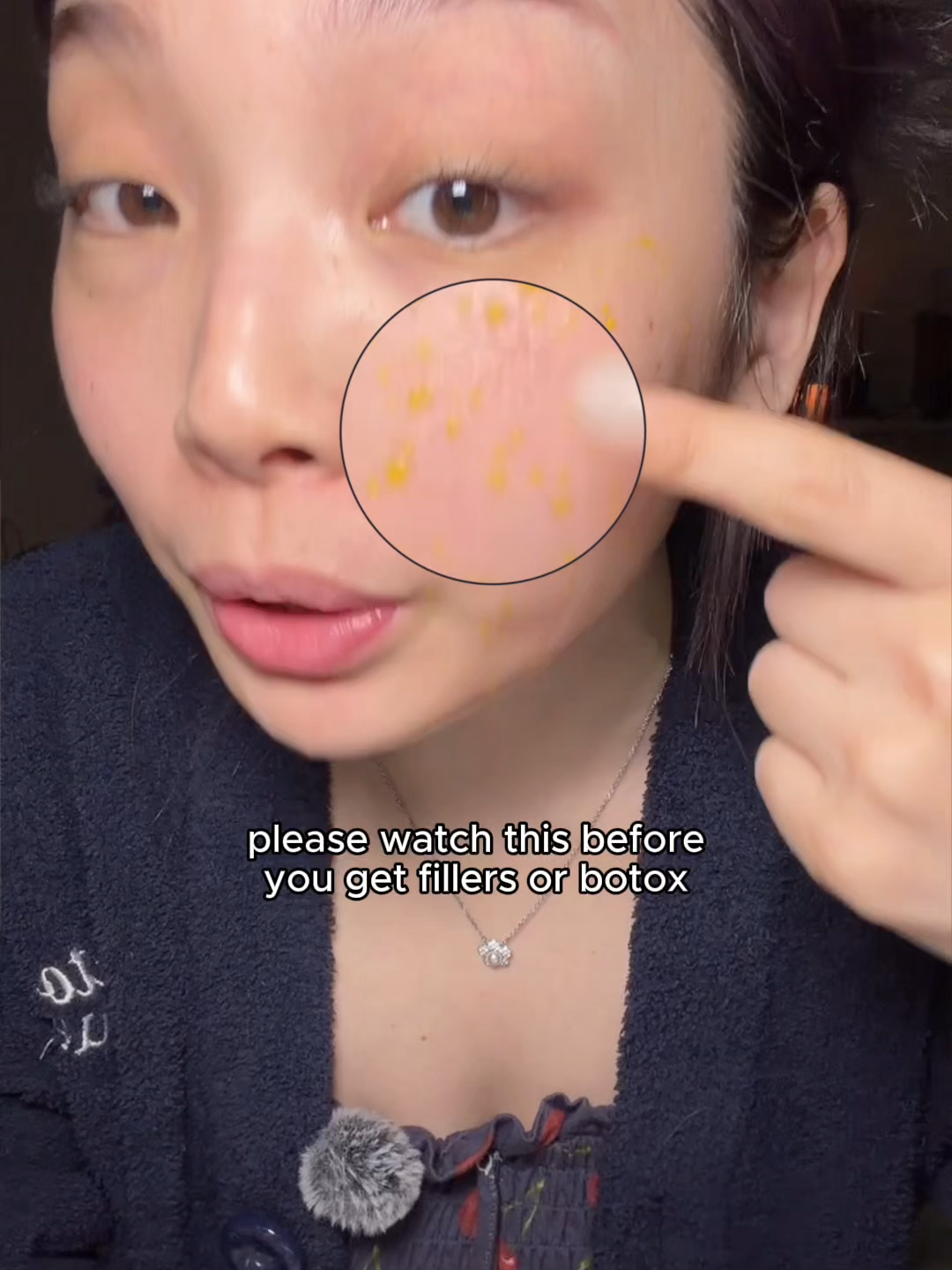 @lily