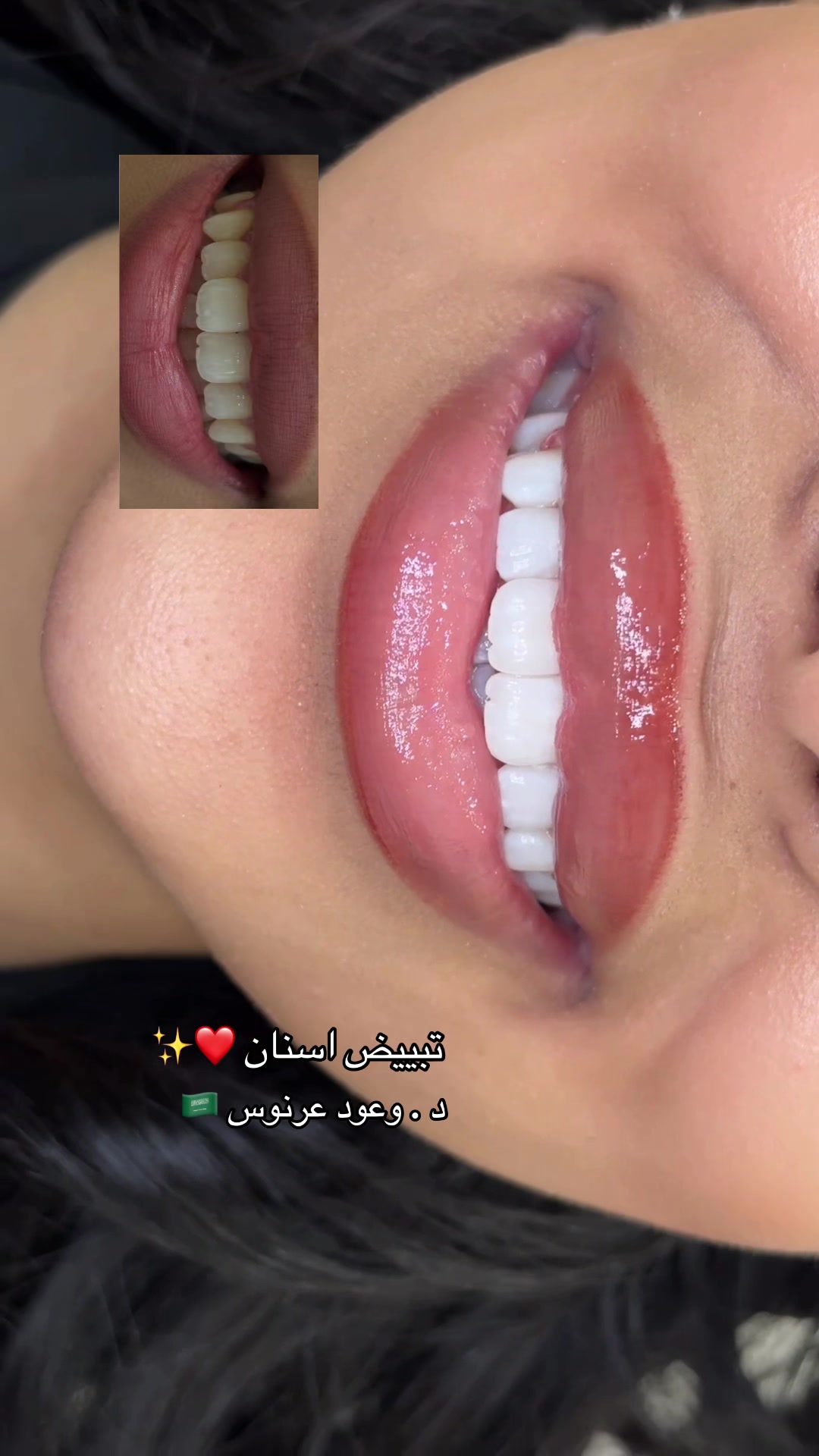 @مركز مزدانه 1 ( فرع الصحافه )