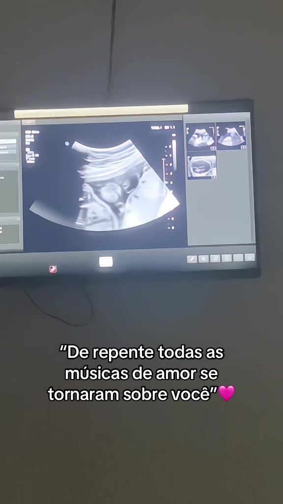 @Arianny Valentim