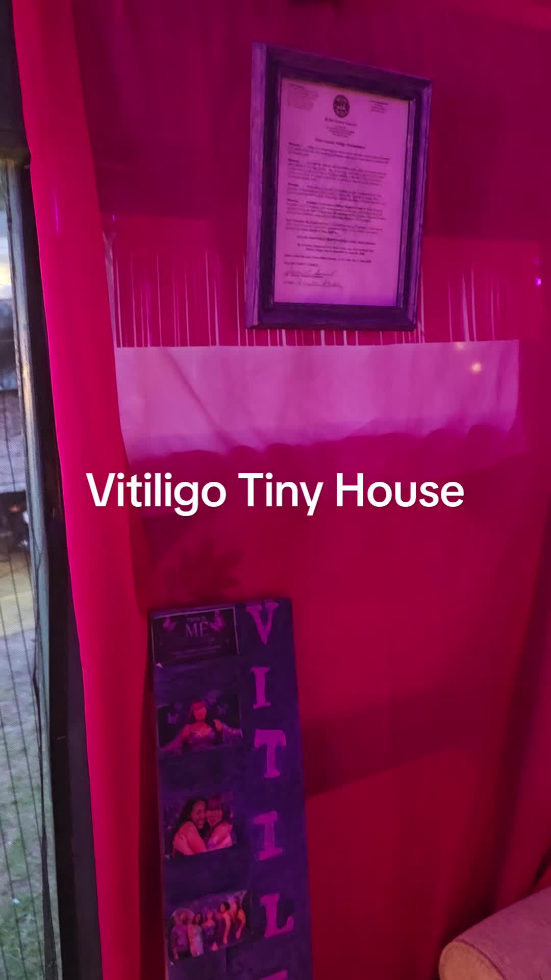 @Miss. PinkY(vitiligo girl)