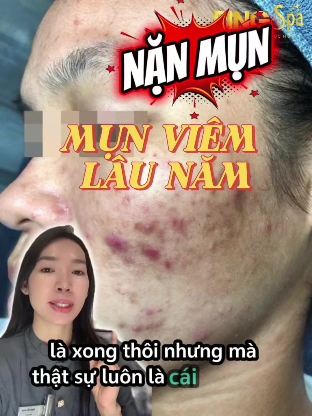 @Ring_Spa