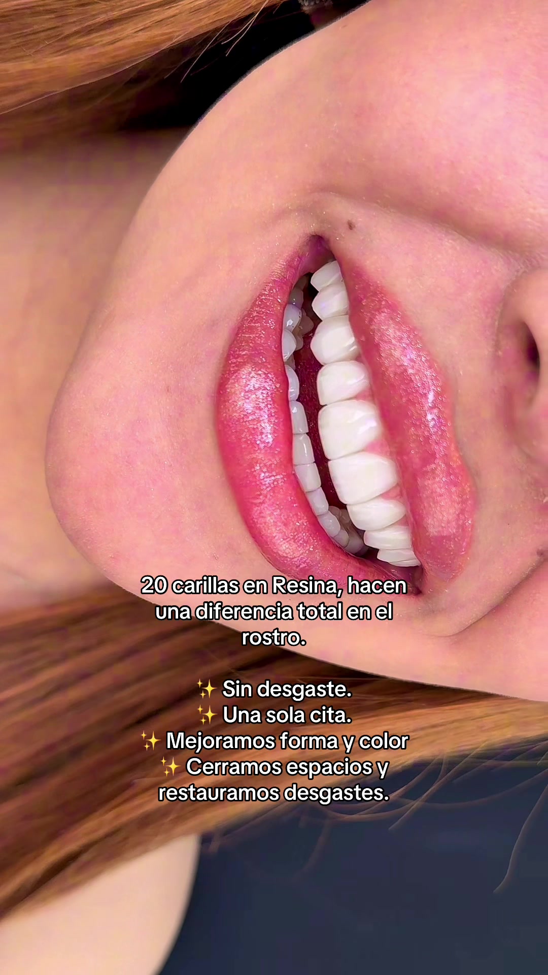 @mayesoficial 🦷🪥