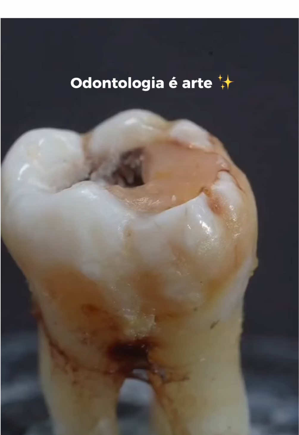@Edinei Dias