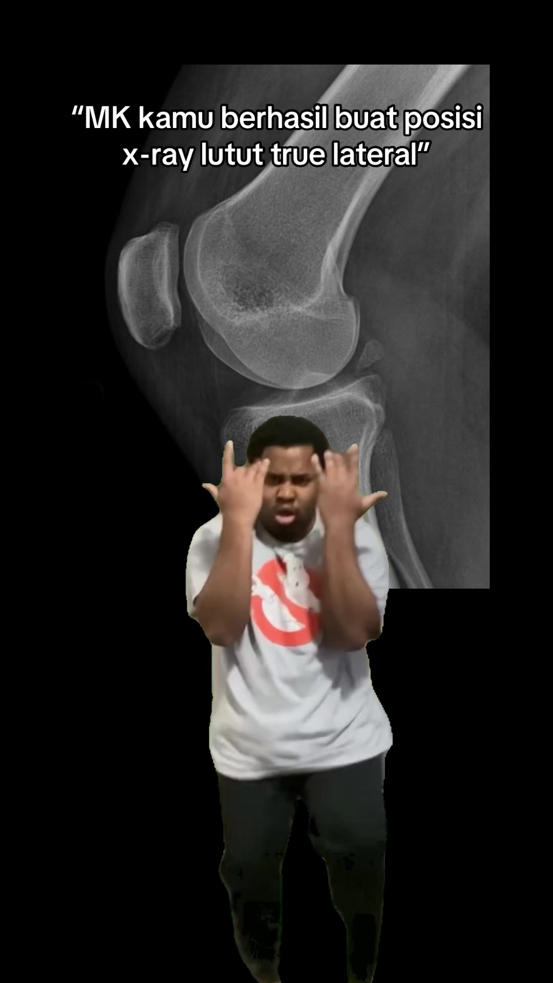@Sobat Radiology