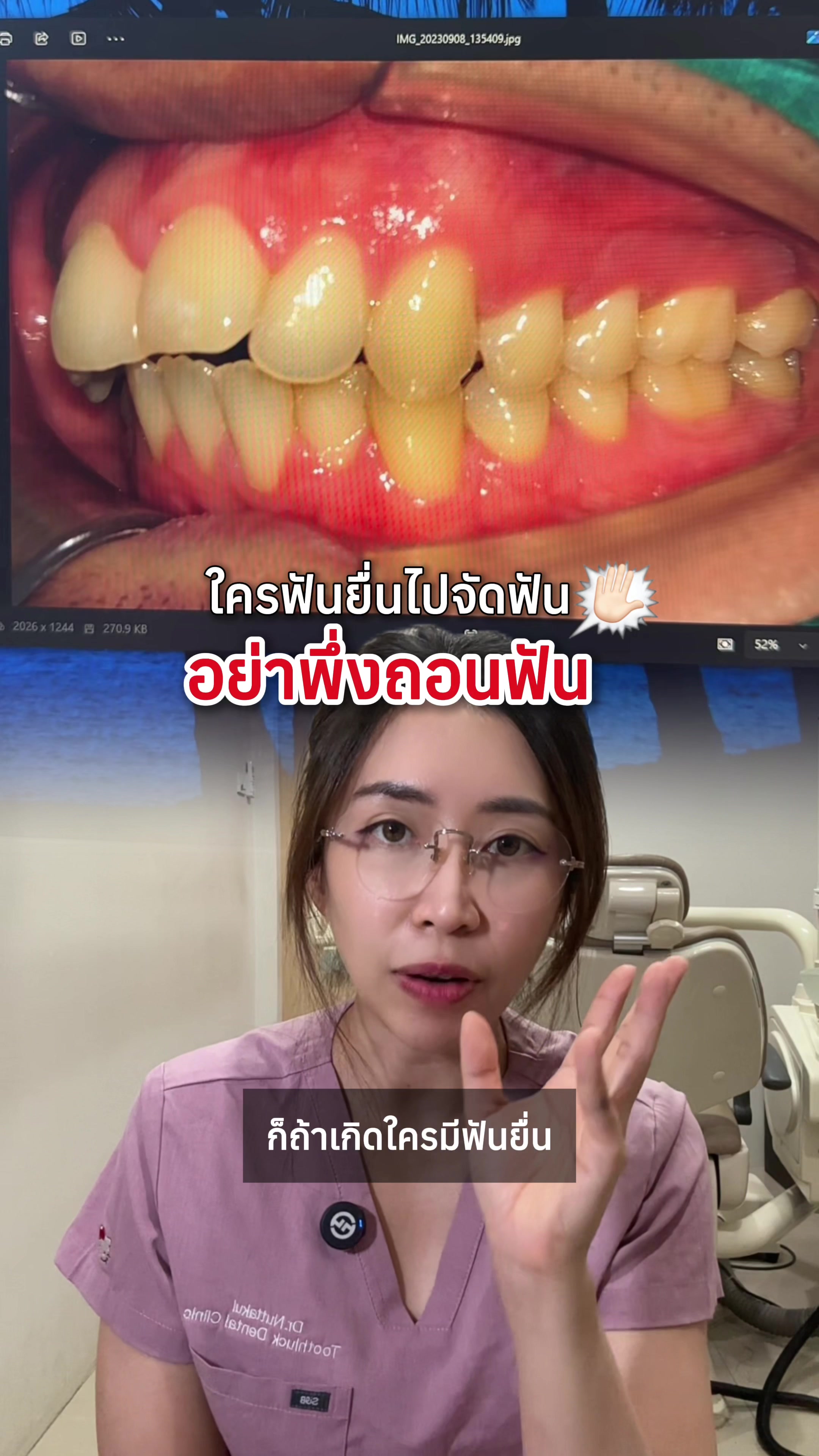 @ณัฐคุณ (Nuttakul Dent) 🦷