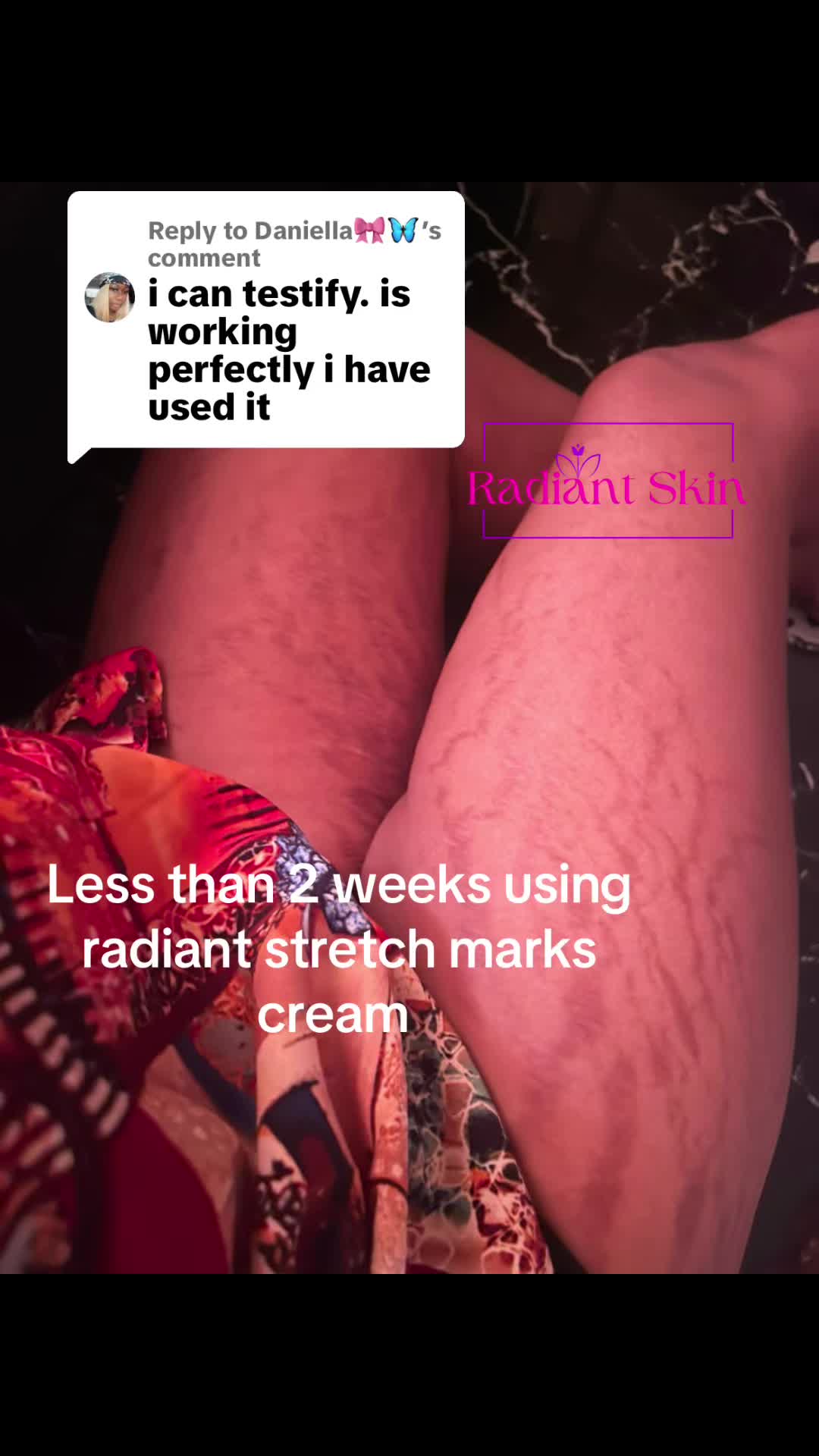 @Radiant skin