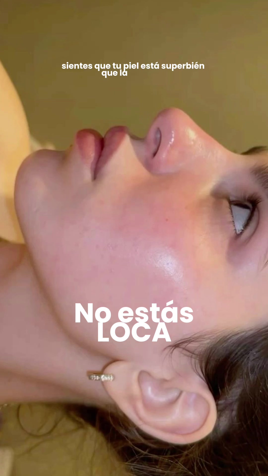 @Ray Skintips