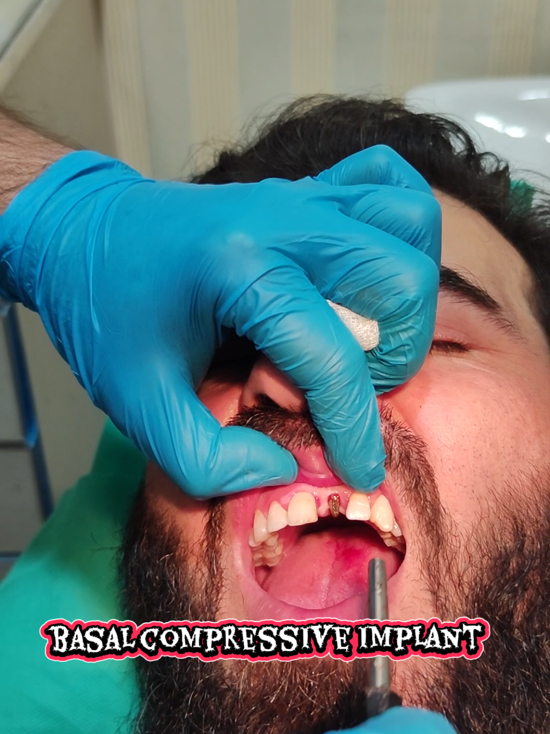 @Dentology by dr.Wajidali