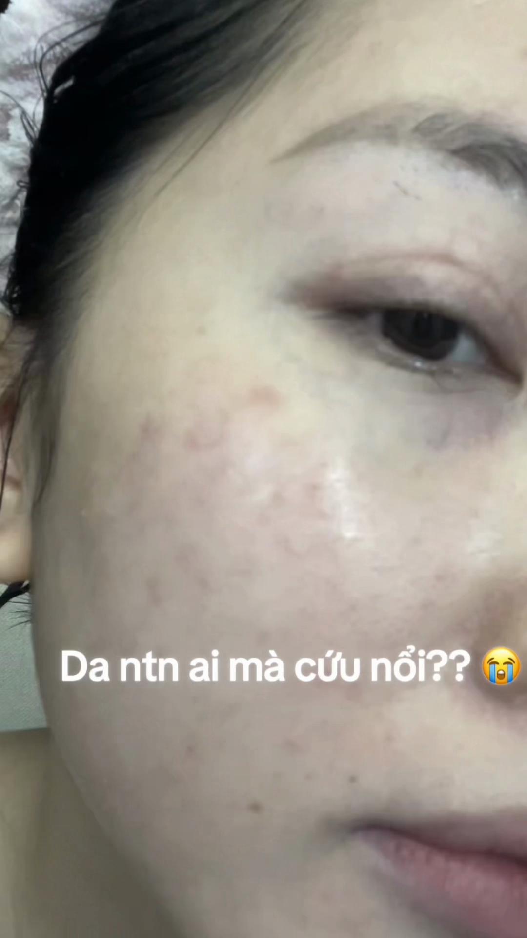@AN LAN MAN số 2