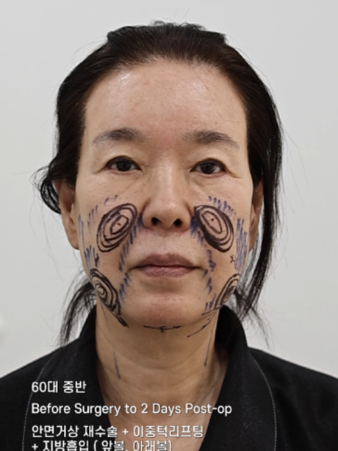 @다시피움성형외과 DASIPIUM タシピウム