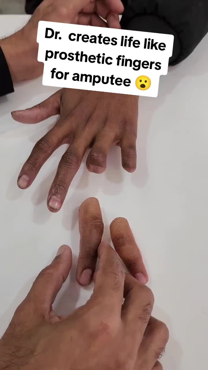 @Martin Extraordinaire