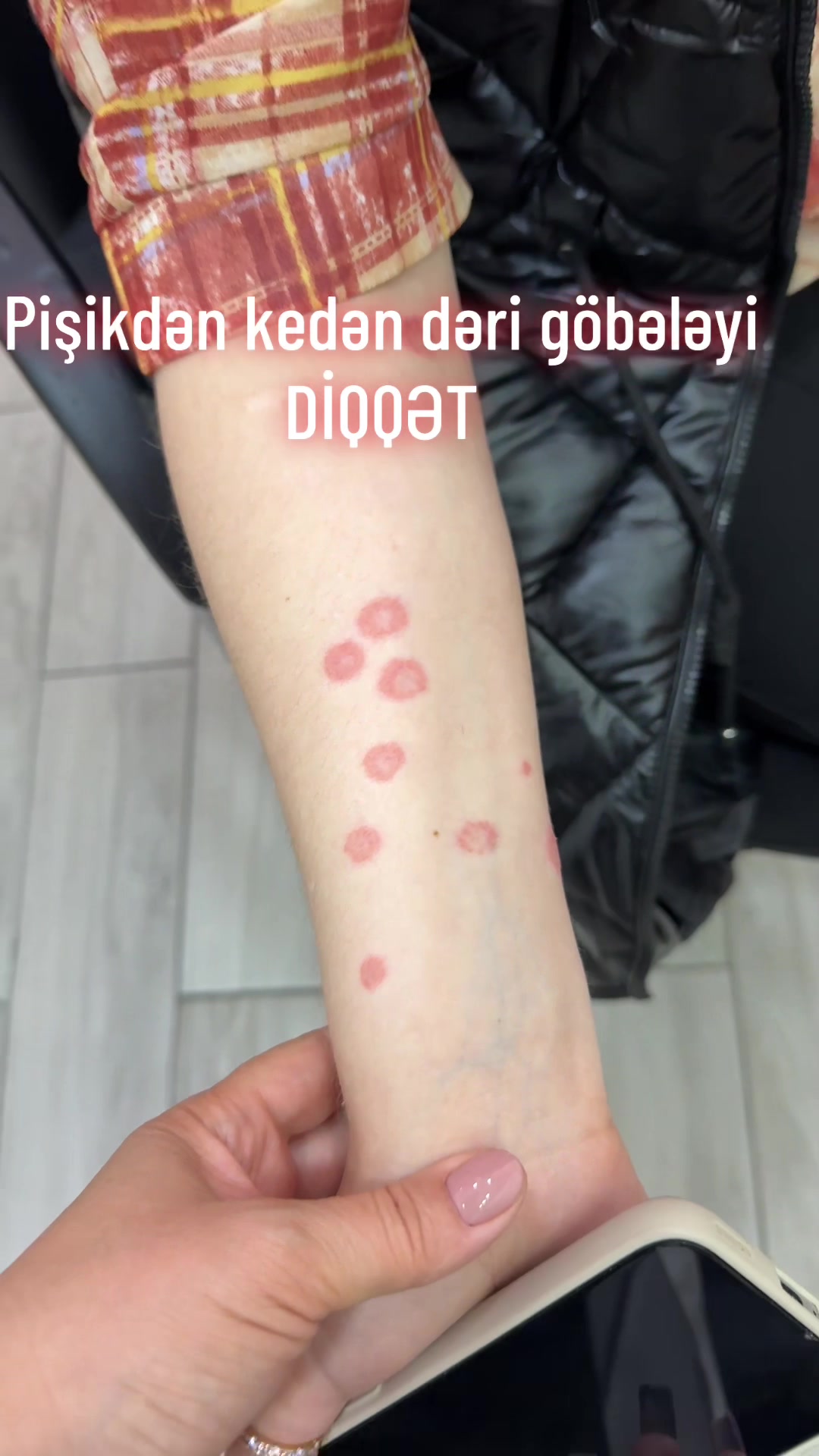 @Dr.kemale.nazarli Dermatoloq