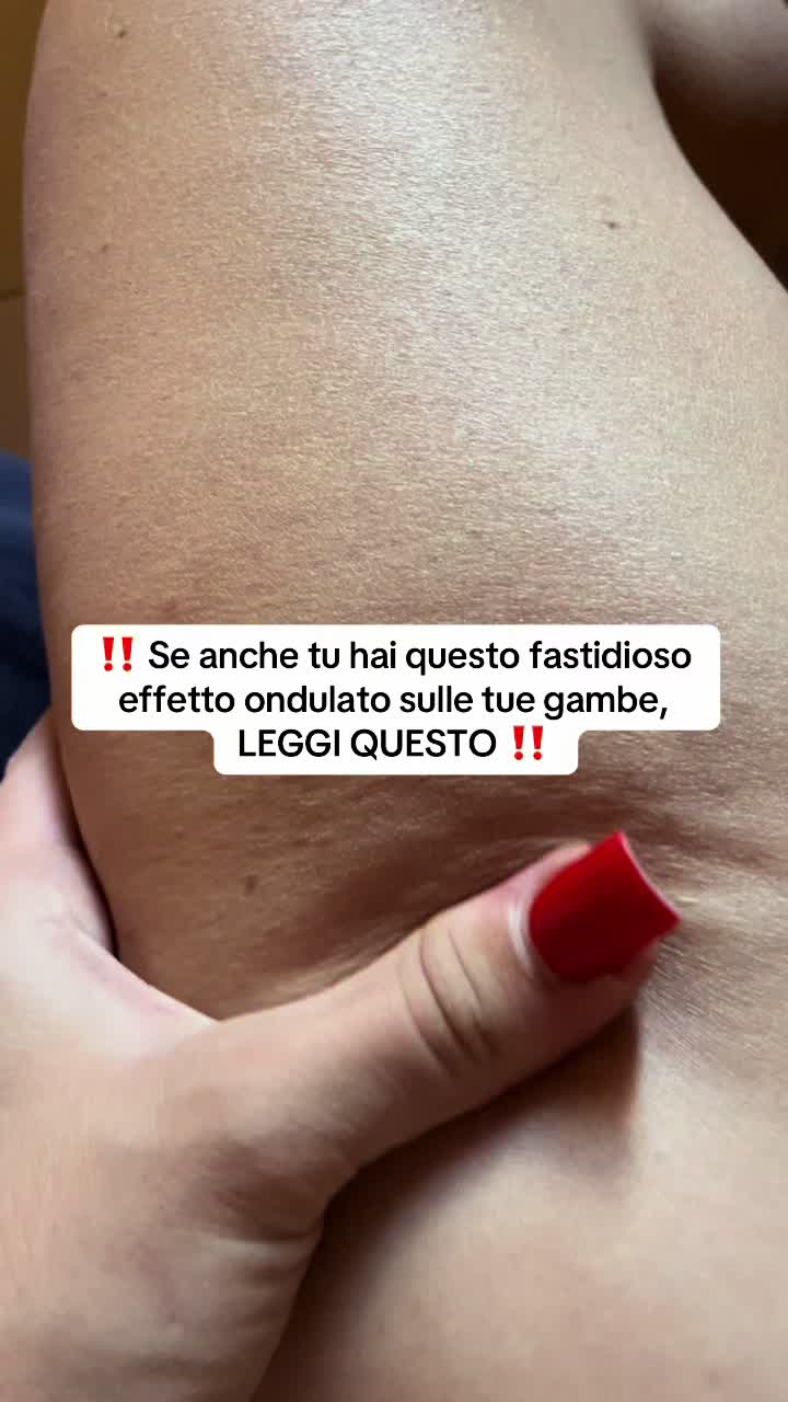 @Lu🌟 stop-cellulite_ritenzione