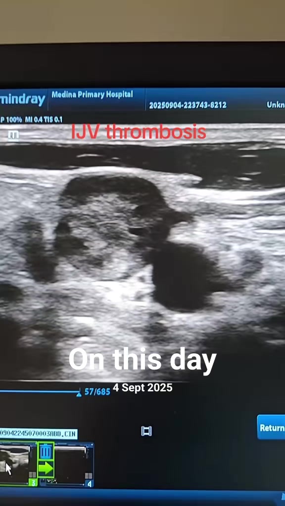 @Dr Wubie Endalew(Radiologist)