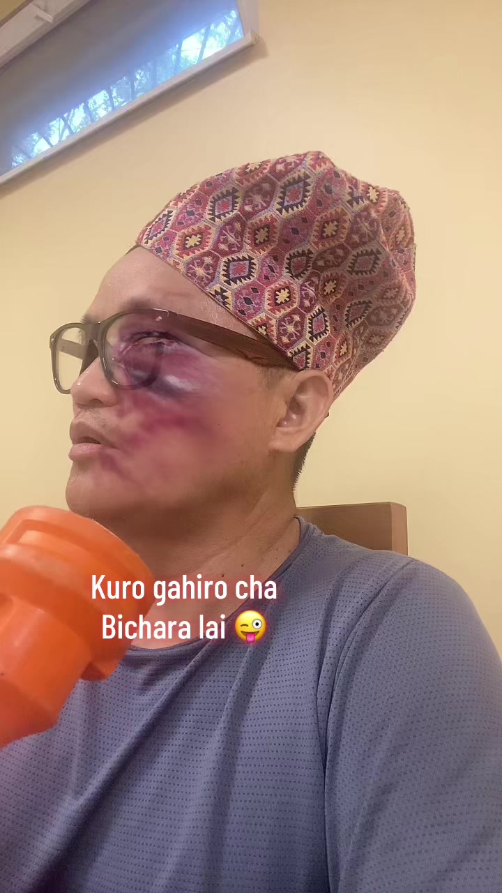 @Raj kumar gurung