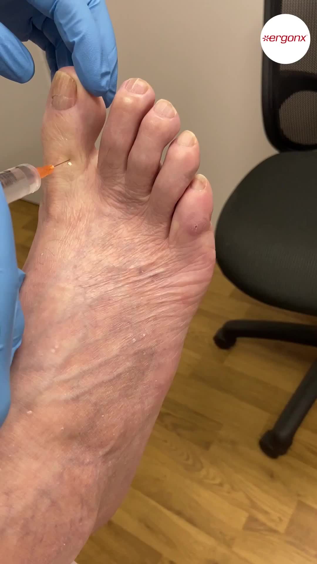 @ergonx