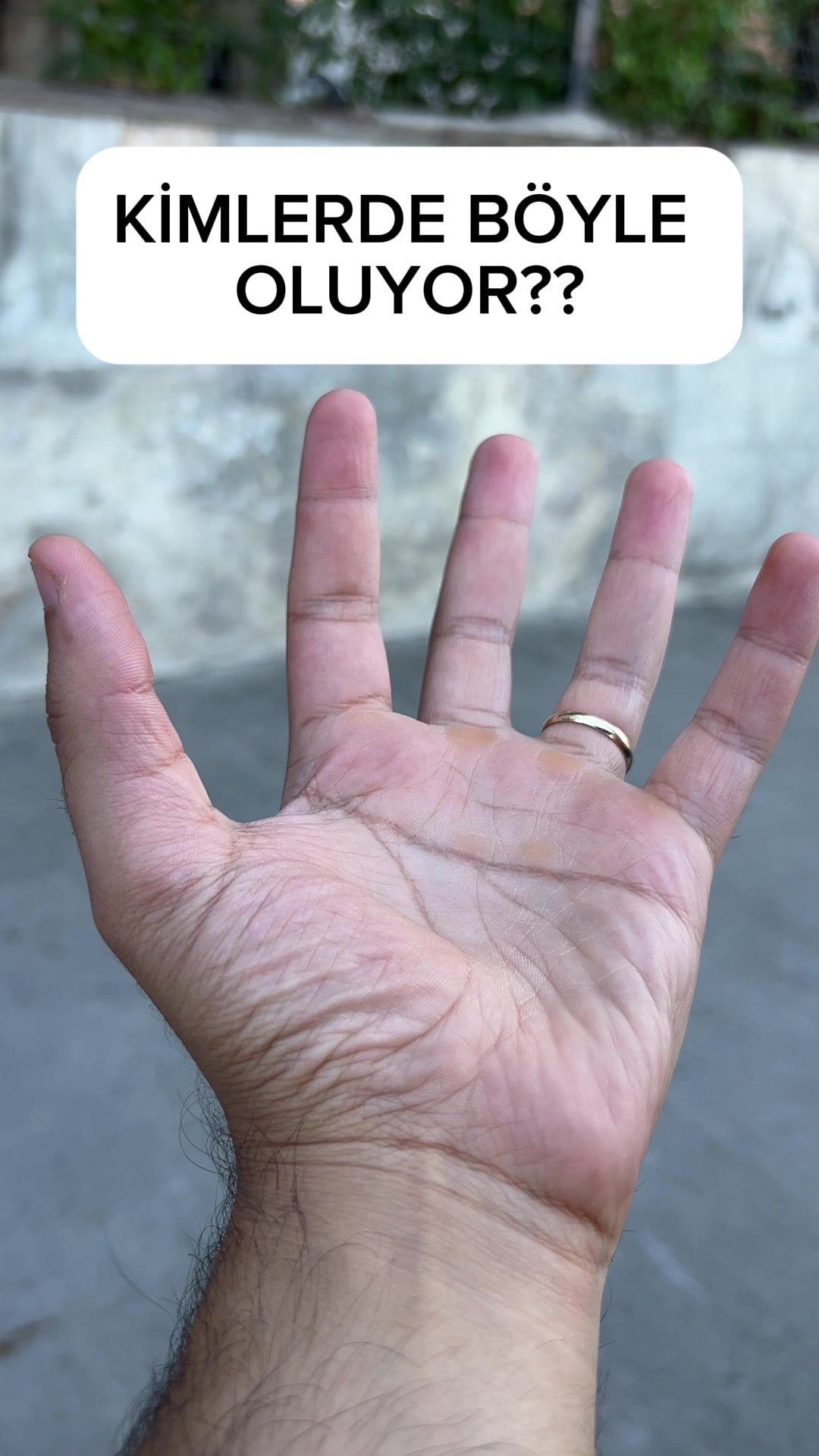 @Fizyoterapist_Cüneyt