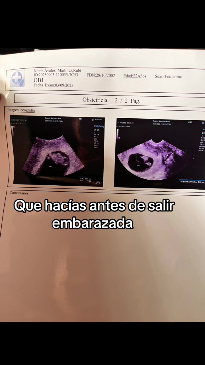 @Rubi Avalos