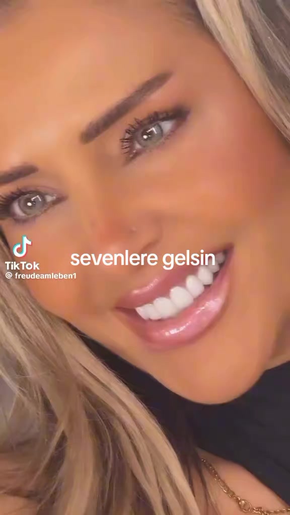 @81 D&uuml;zce