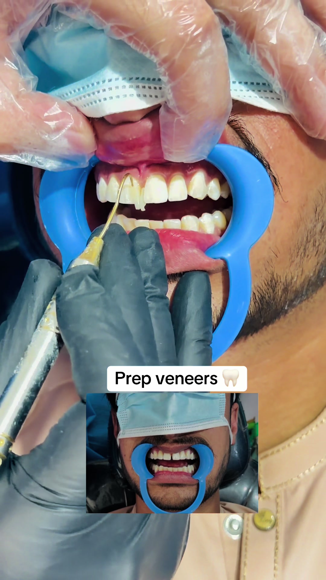 @DR Bilal Official🦷