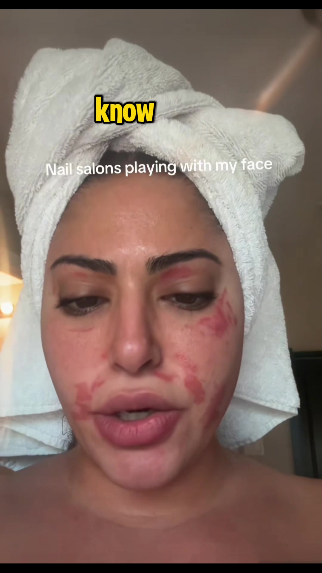 @Pure Skin OC