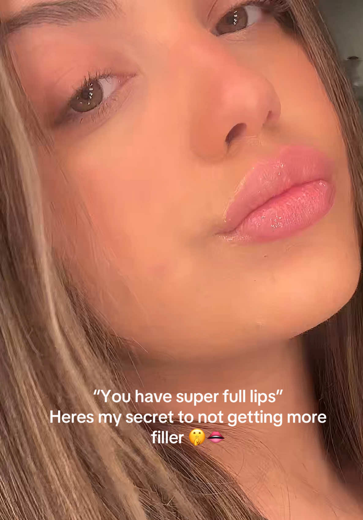 @gi